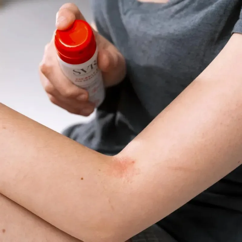 SVR Cicavit+ Sos Grattage Spray Apaisant 40 ml — photo 2