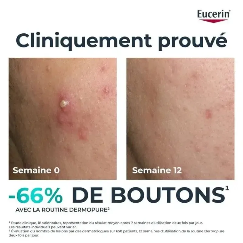 EUCERIN Dermopure Sérum Triple Action 40 ml — photo 2