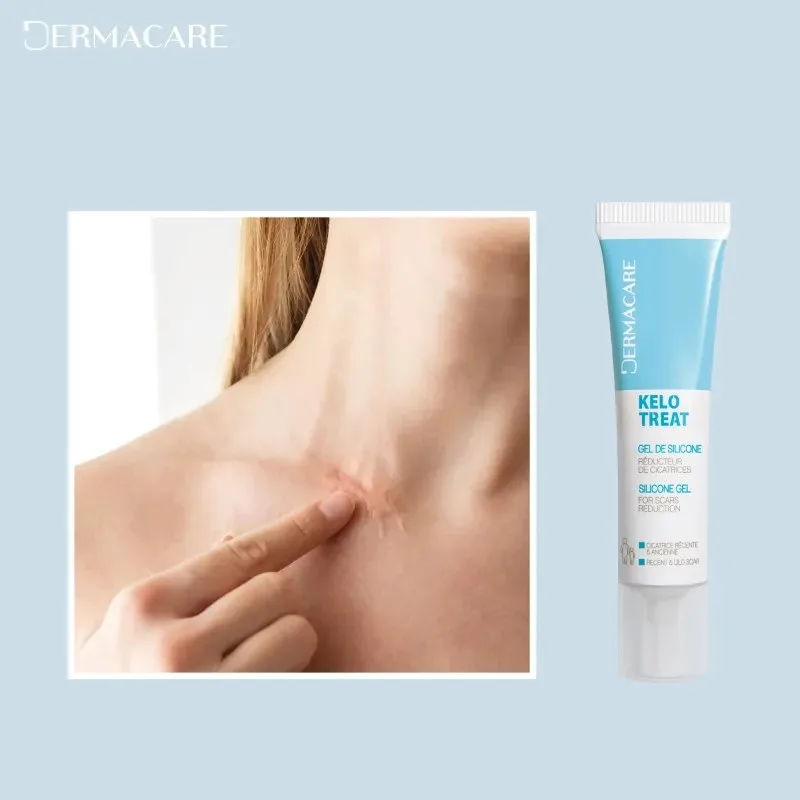 DERMACARE Kelo Treat 15 ml — photo 2