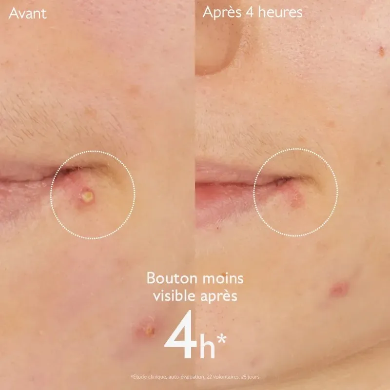 CAUDALIE Vinopure Stop Boutons Salicylique 15 ml — photo 3