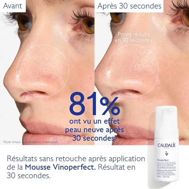 CAUDALIE Vinoperfect Mousse Micro-Peeling Éclat 100 ml — photo 3