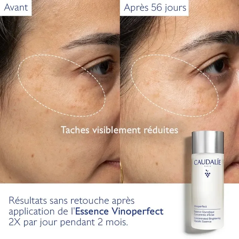 CAUDALIE Vinoperfect Essence Glycolique Concentrée d'Éclat 100 ml — photo 3